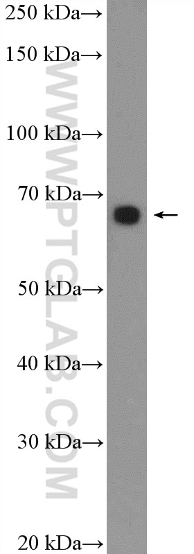 Western Blot (WB) analysis of NCCIT cells using GRHL1 Polyclonal antibody (17644-1-AP)