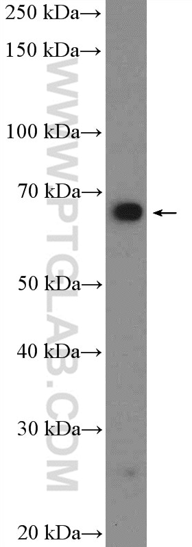 Western Blot (WB) analysis of NCCIT cells using GRHL1 Polyclonal antibody (17644-1-AP)