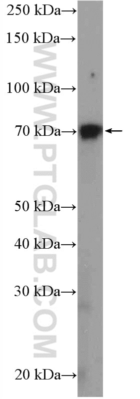 Western Blot (WB) analysis of NCCIT cells using GRHL1 Polyclonal antibody (17644-1-AP)