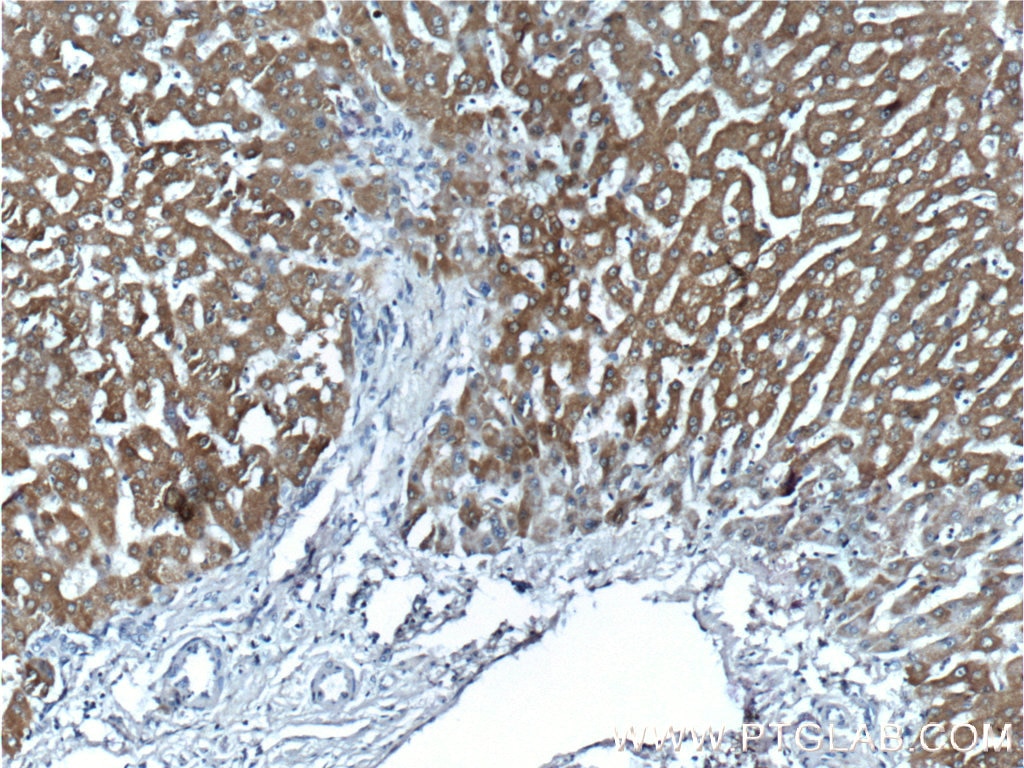 Immunohistochemistry (IHC) staining of human liver tissue using GRHPR Polyclonal antibody (51013-2-AP)