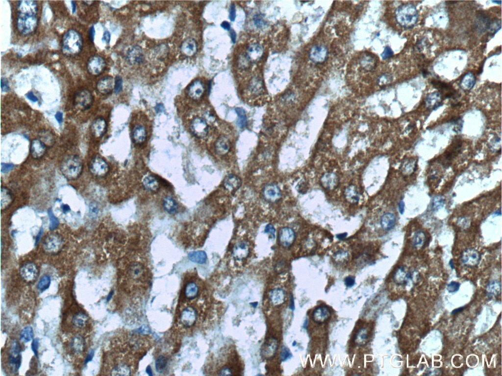 Immunohistochemistry (IHC) staining of human liver tissue using GRHPR Polyclonal antibody (51013-2-AP)