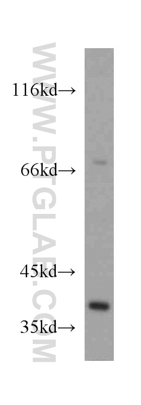 Western Blot (WB) analysis of L02 cells using GRHPR Polyclonal antibody (51013-2-AP)