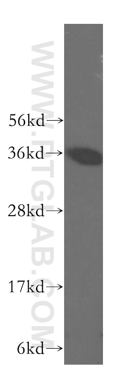 Western Blot (WB) analysis of human liver tissue using GRHPR Polyclonal antibody (51013-2-AP)