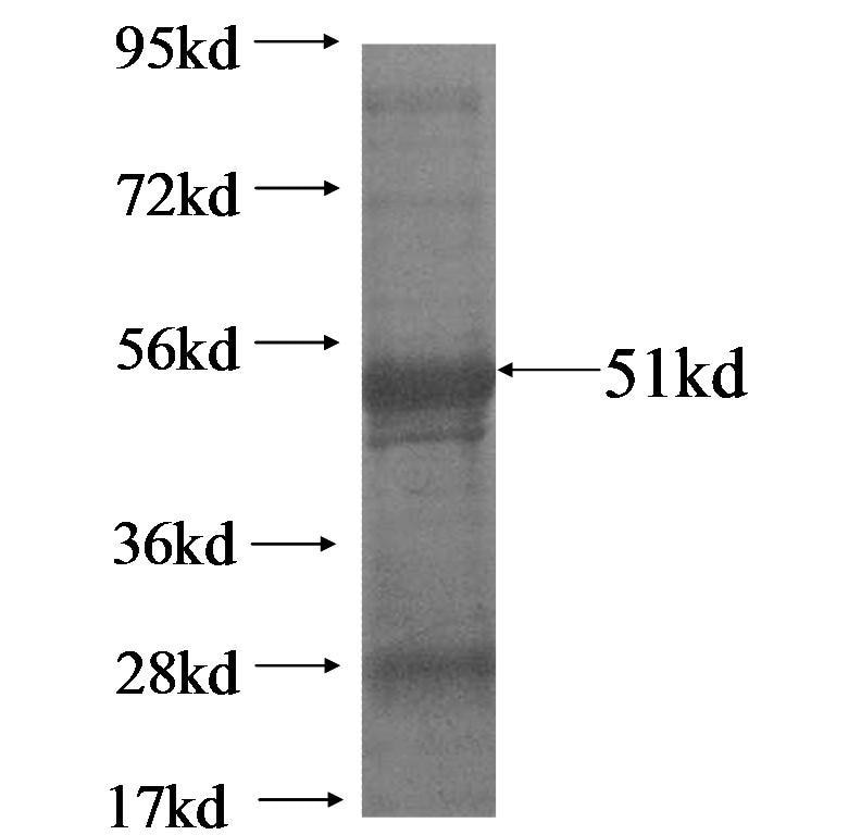 GRHPR fusion protein Ag0484 SDS-PAGE