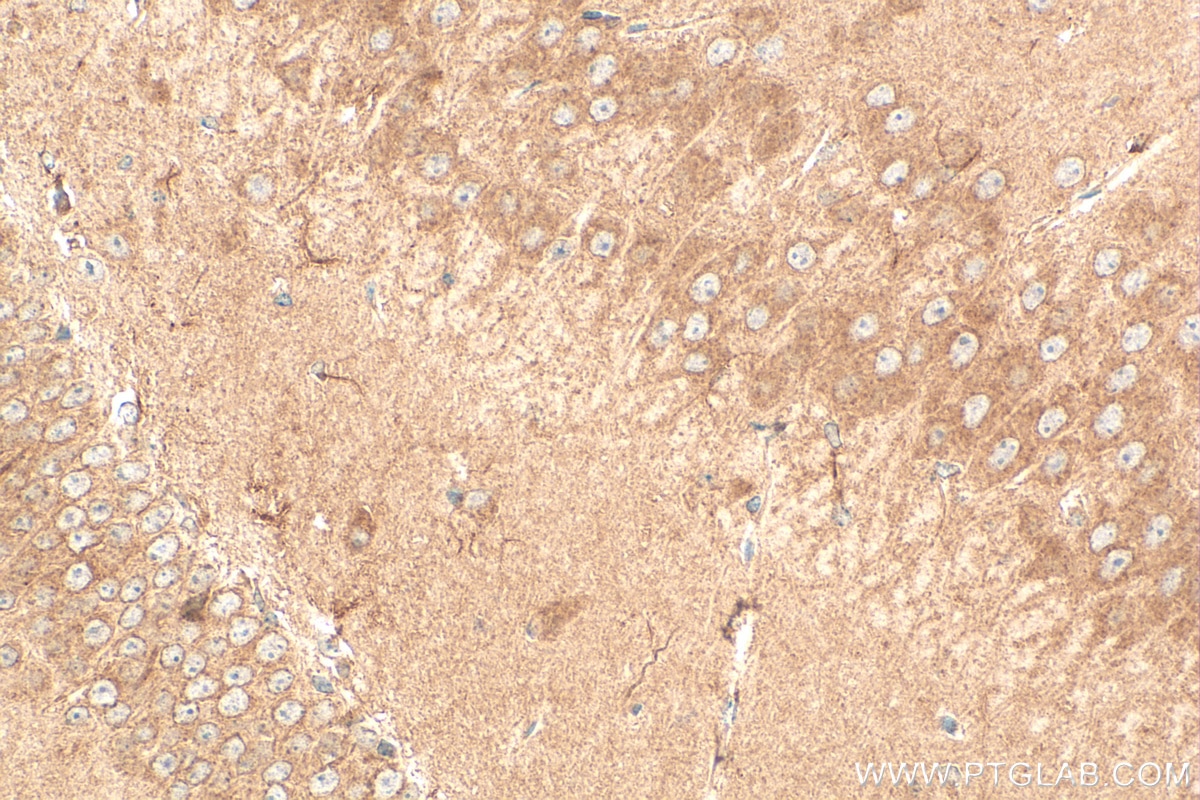 Immunohistochemistry (IHC) staining of mouse brain tissue using GRIA1 Polyclonal antibody (25012-1-AP)
