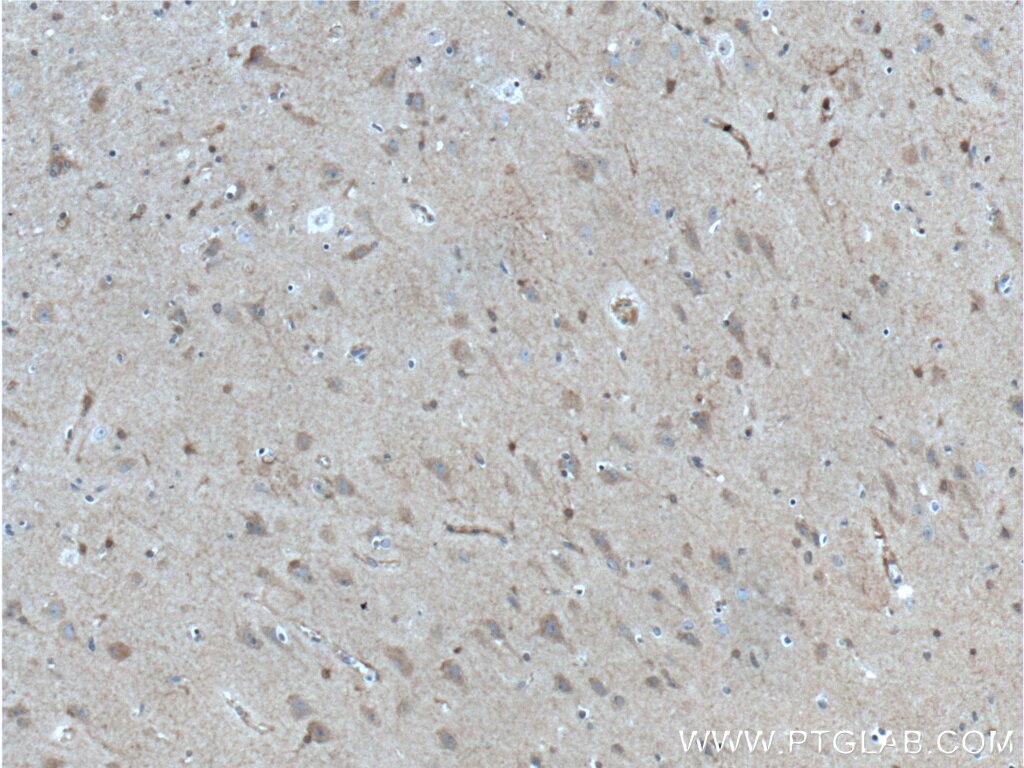 Immunohistochemistry (IHC) staining of human brain tissue using GRIA1 Polyclonal antibody (25012-1-AP)