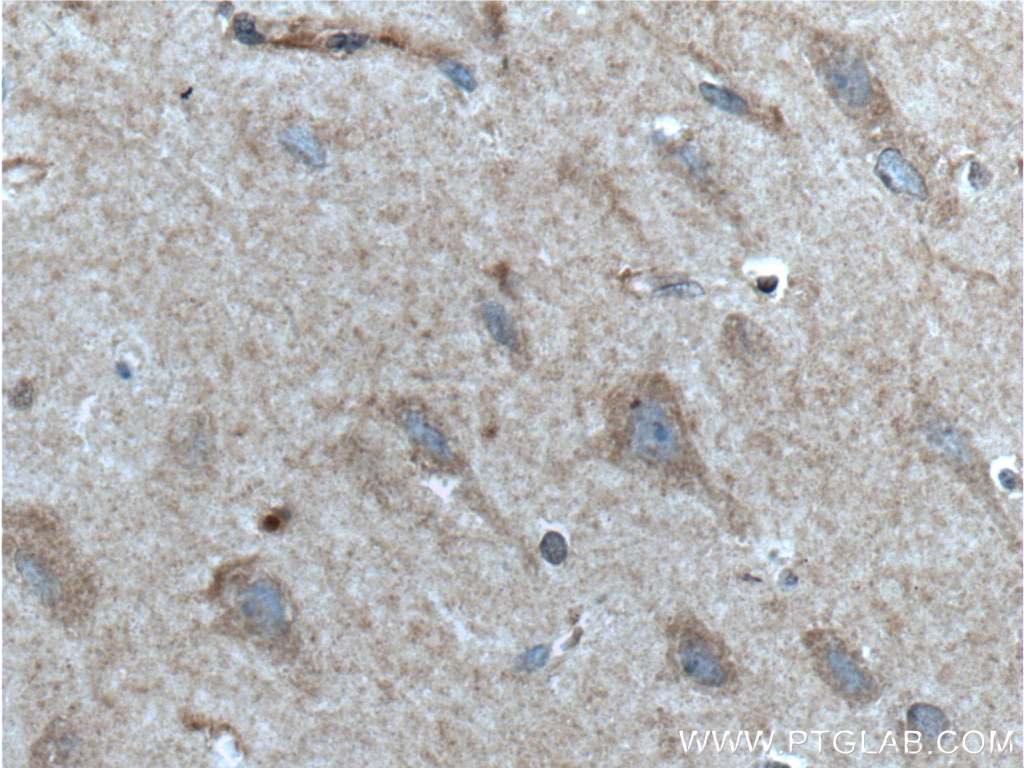 Immunohistochemistry (IHC) staining of human brain tissue using GRIA1 Polyclonal antibody (25012-1-AP)