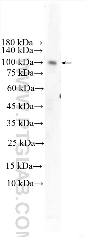 Western Blot (WB) analysis of various lysates using GRIA1 Polyclonal antibody (25012-1-AP)