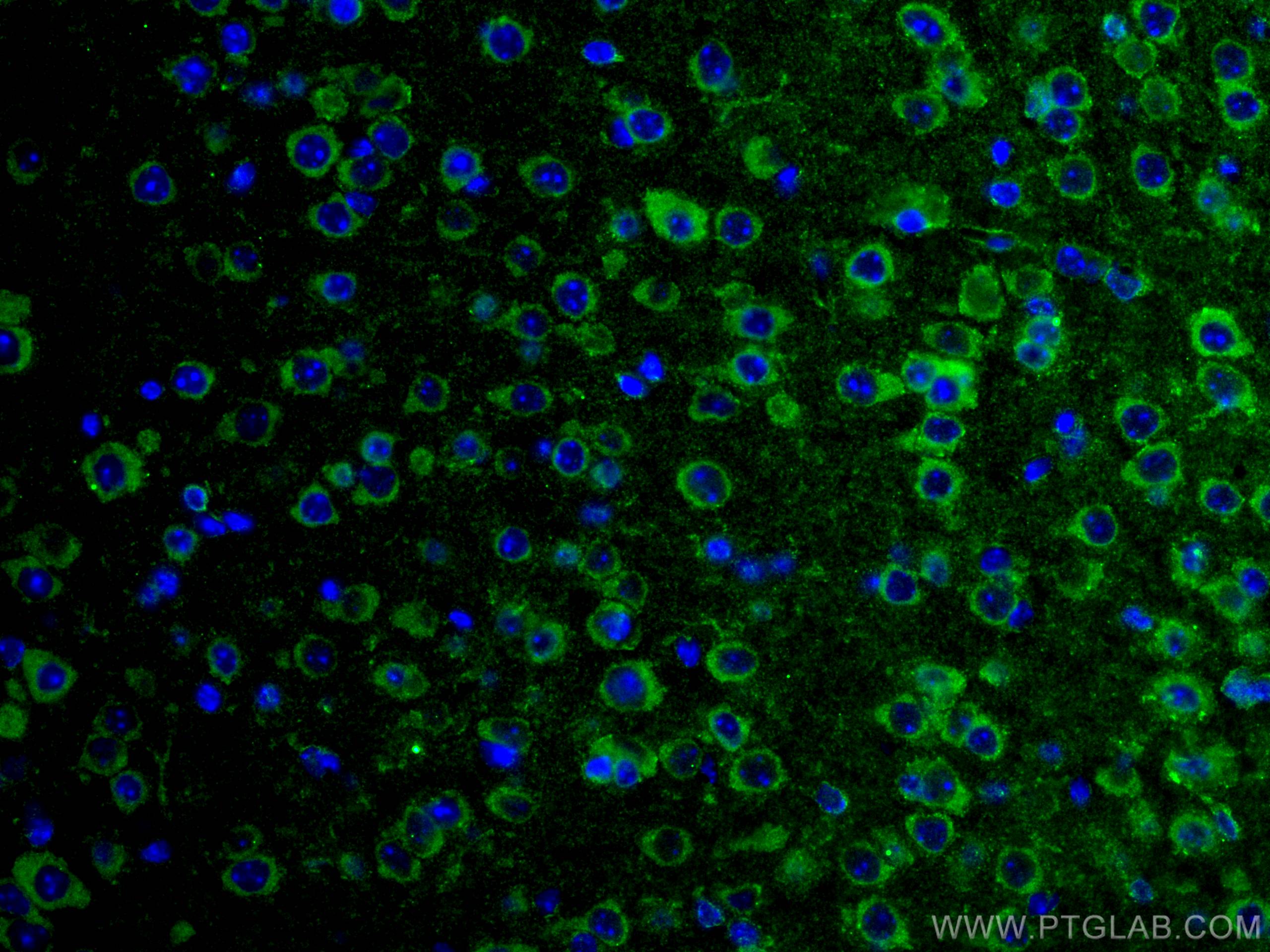 Immunofluorescence (IF) / fluorescent staining of mouse brain tissue using GRIA1 Monoclonal antibody (67642-1-Ig)
