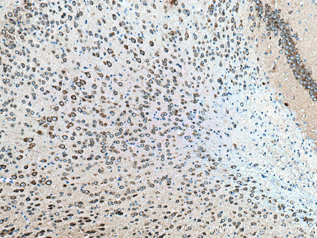 Immunohistochemistry (IHC) staining of mouse brain tissue using GRIA1 Monoclonal antibody (67642-1-Ig)