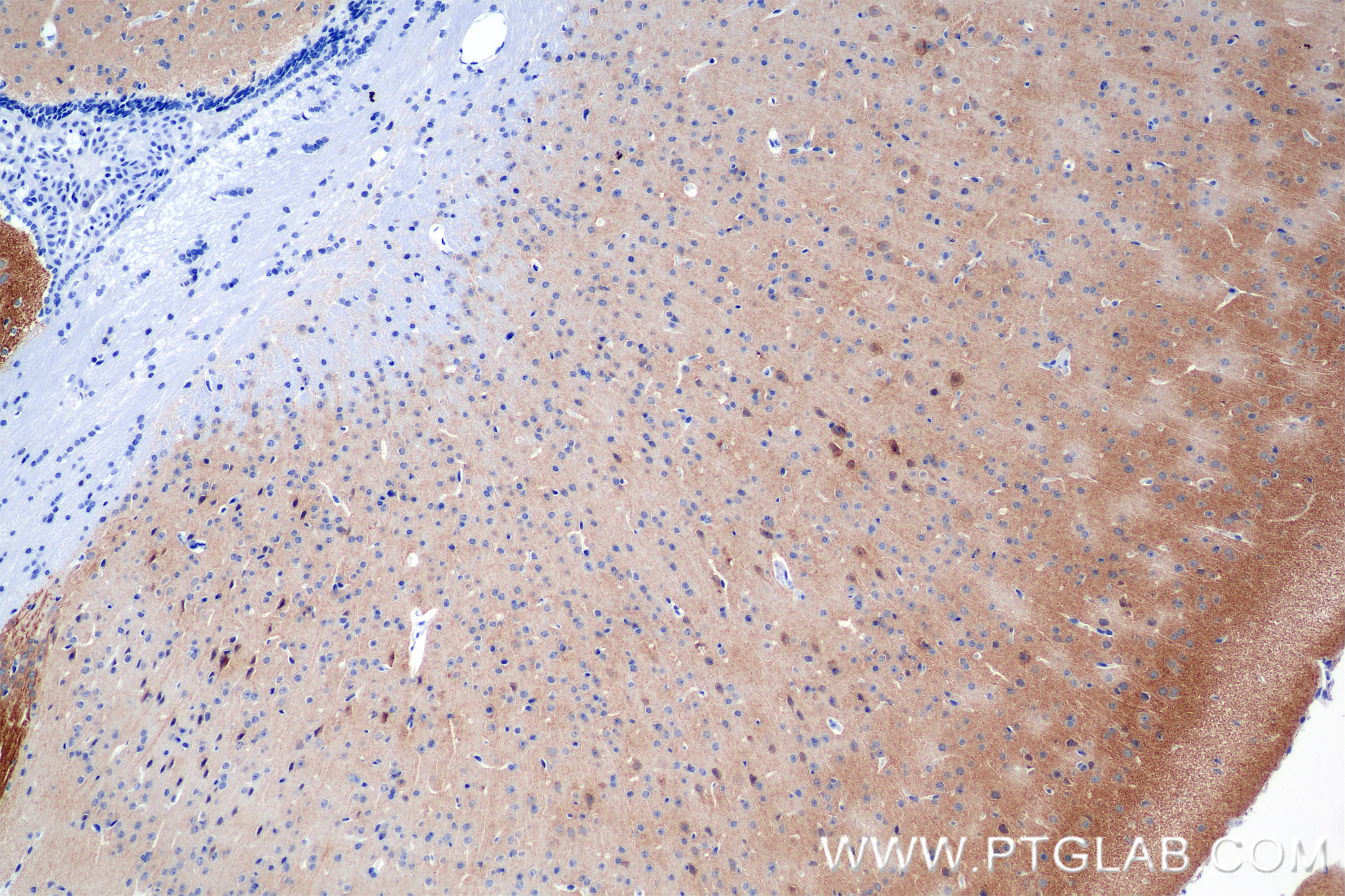 Immunohistochemistry (IHC) staining of mouse brain tissue using GRIA1 Recombinant antibody (85333-1-RR)