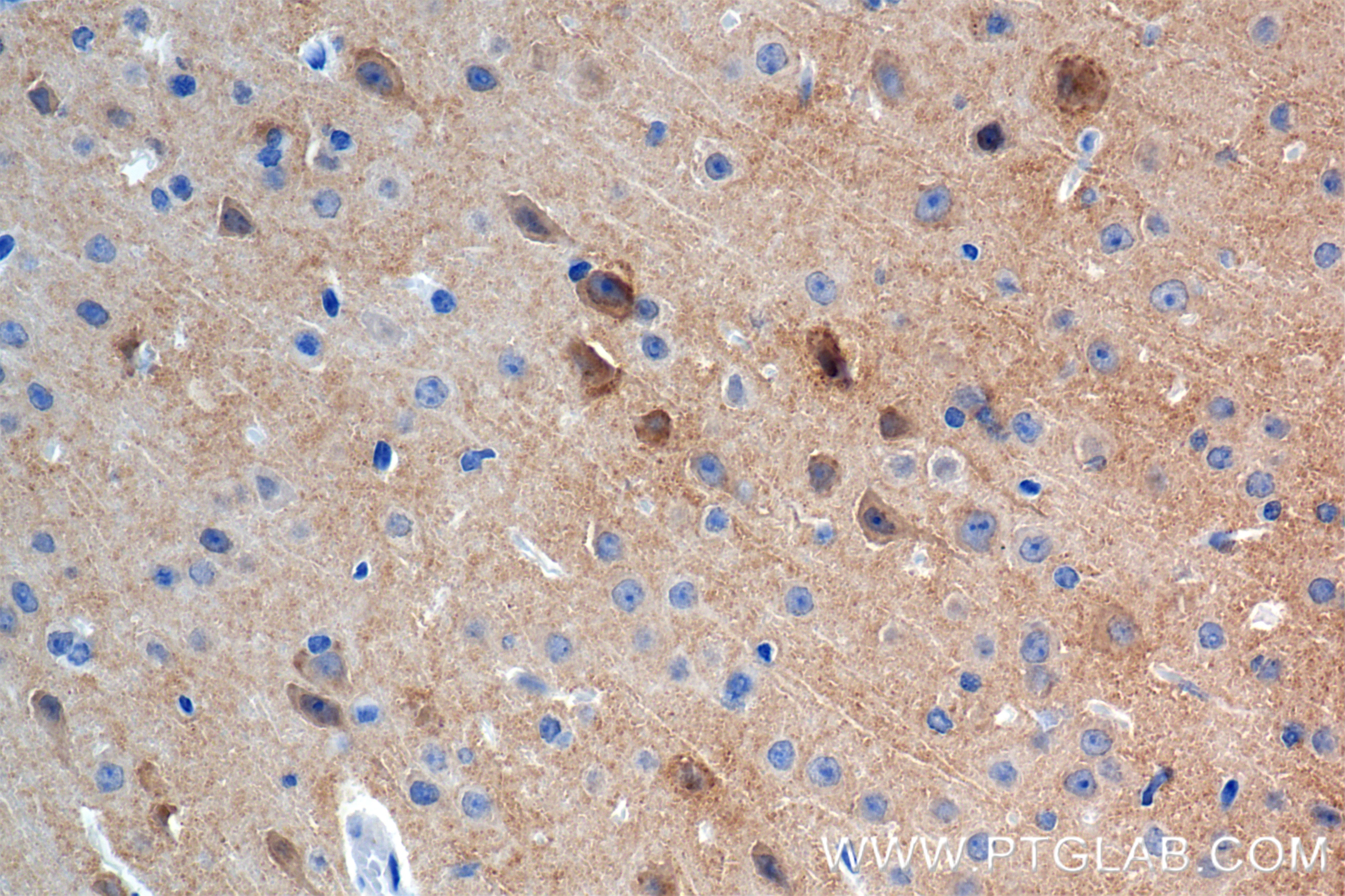 Immunohistochemistry (IHC) staining of mouse brain tissue using GRIA1 Recombinant antibody (85333-1-RR)
