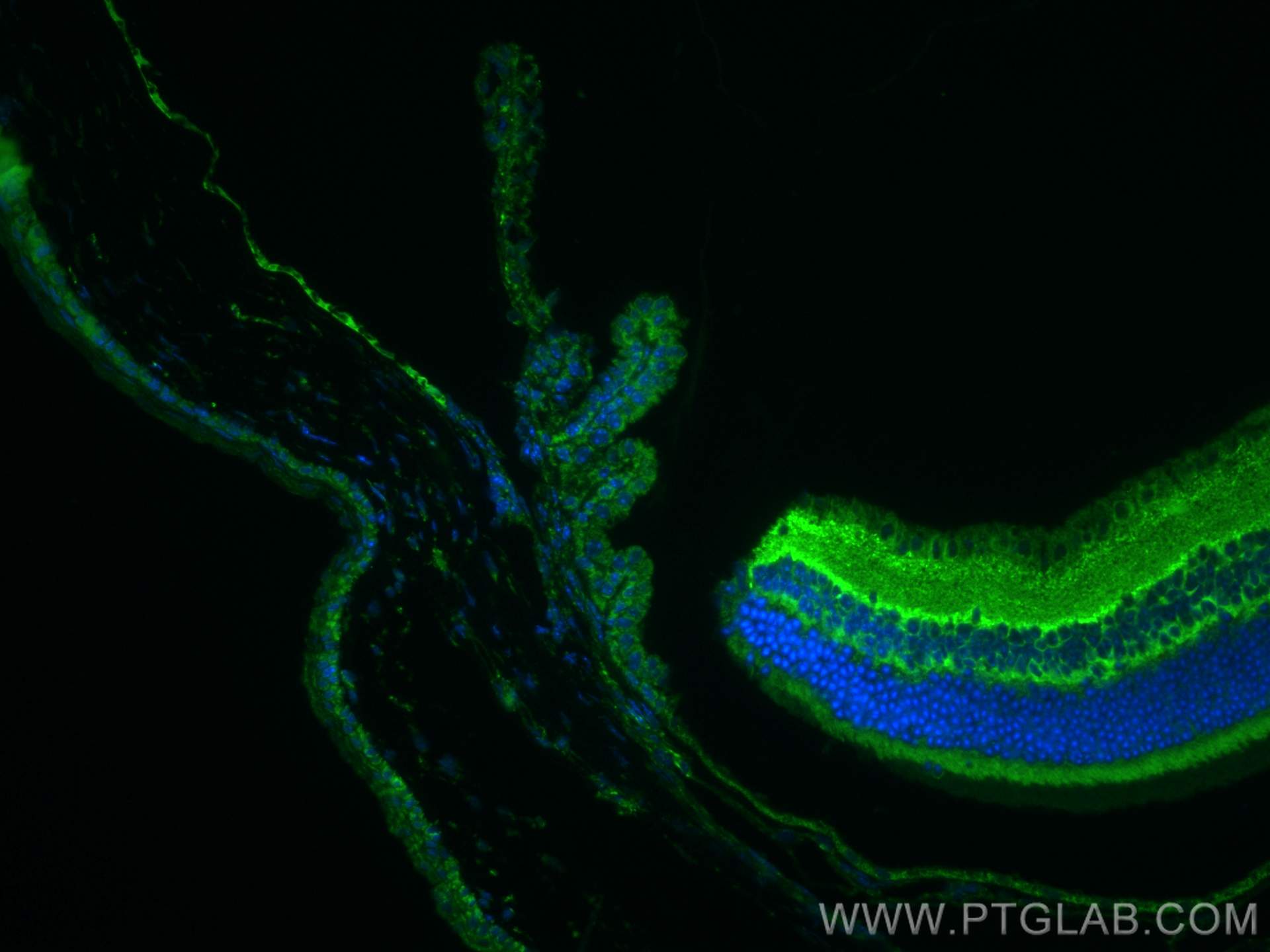 Immunofluorescence (IF) / fluorescent staining of mouse eye tissue using Glutamate receptor 2 Polyclonal antibody (11994-1-AP)