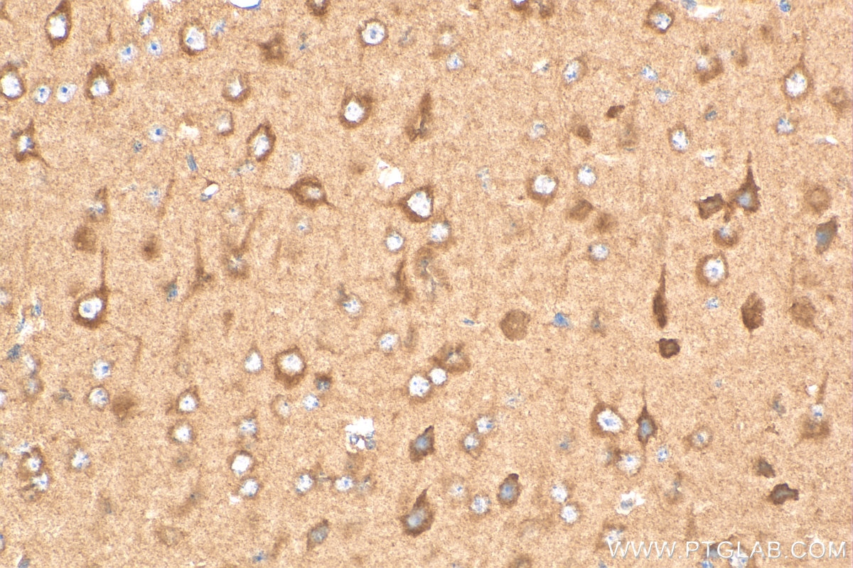 Immunohistochemistry (IHC) staining of mouse brain tissue using Glutamate receptor 2 Polyclonal antibody (11994-1-AP)