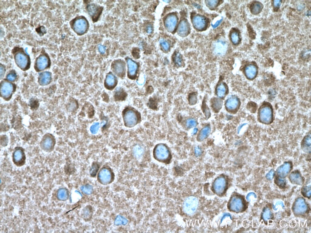 Immunohistochemistry (IHC) staining of mouse brain tissue using Glutamate receptor 2 Polyclonal antibody (11994-1-AP)