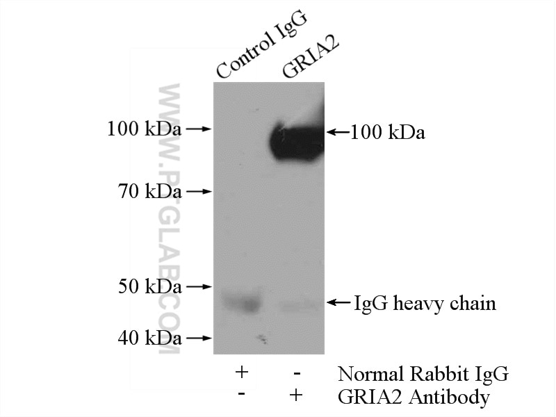 Glutamate receptor 2 Polyclonal antibody