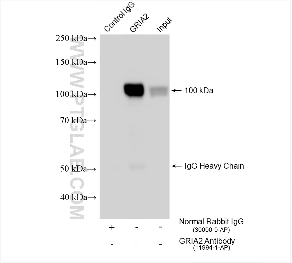 Immunoprecipitation (IP) experiment of mouse brain tissue using Glutamate receptor 2 Polyclonal antibody (11994-1-AP)