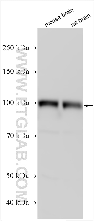 Western Blot (WB) analysis of various lysates using Glutamate receptor 2 Polyclonal antibody (11994-1-AP)