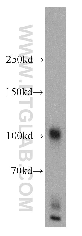 Western Blot (WB) analysis of human brain tissue using Glutamate receptor 2 Polyclonal antibody (11994-1-AP)