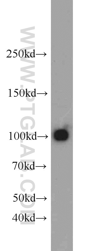Western Blot (WB) analysis of mouse brain tissue using Glutamate receptor 2 Polyclonal antibody (11994-1-AP)