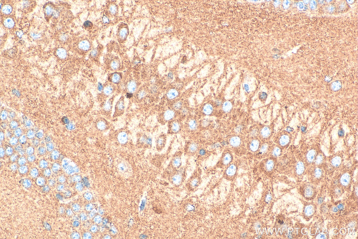 Immunohistochemistry (IHC) staining of mouse brain tissue using Glutamate receptor 3/GluA3 Polyclonal antibody (29588-1-AP)