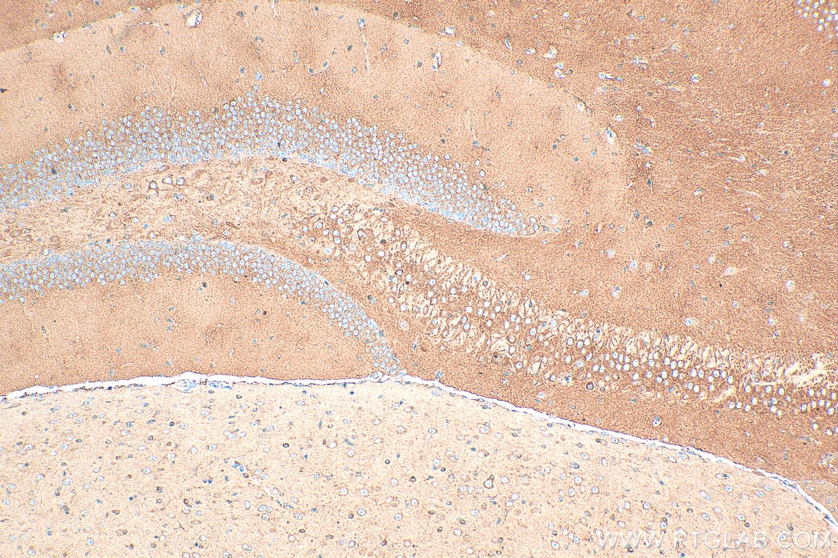 Immunohistochemistry (IHC) staining of mouse brain tissue using Glutamate receptor 3/GluA3 Polyclonal antibody (29588-1-AP)