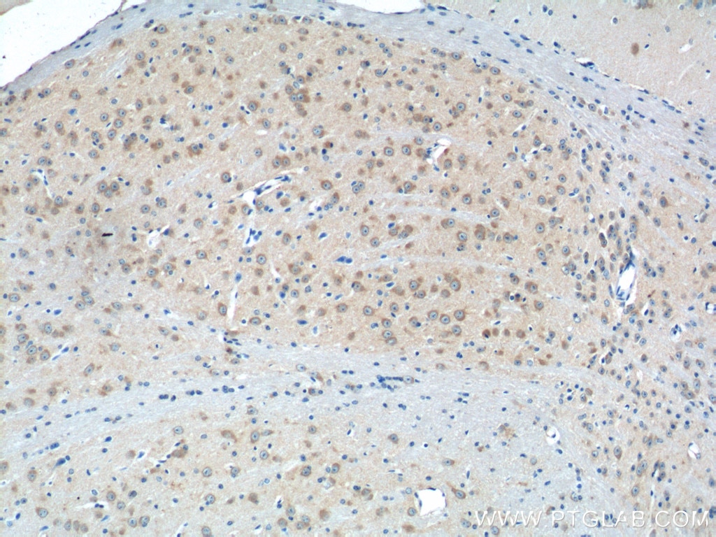 Immunohistochemistry (IHC) staining of mouse brain tissue using GRIA4 Polyclonal antibody (23350-1-AP)