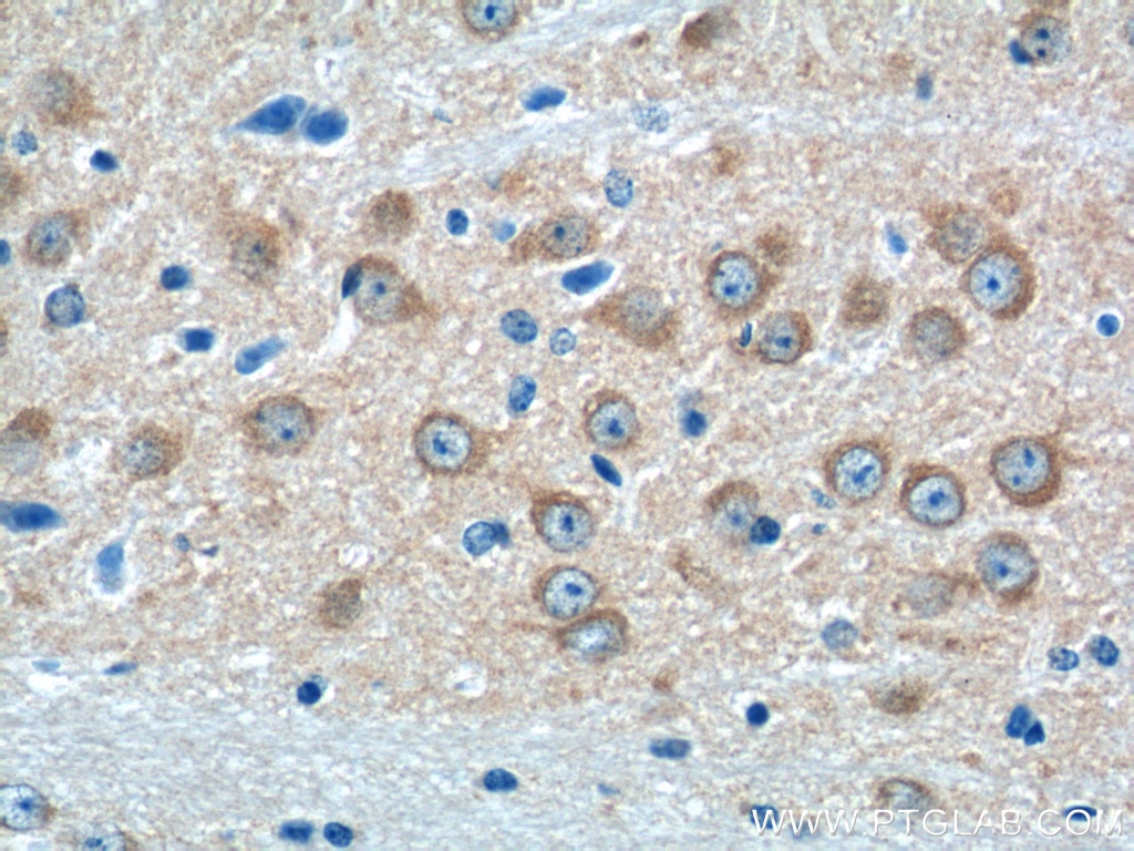 Immunohistochemistry (IHC) staining of mouse brain tissue using GRIA4 Polyclonal antibody (23350-1-AP)