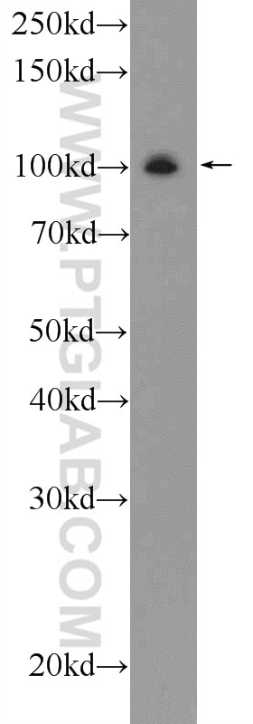 Western Blot (WB) analysis of rat brain tissue using GRIA4 Polyclonal antibody (23350-1-AP)