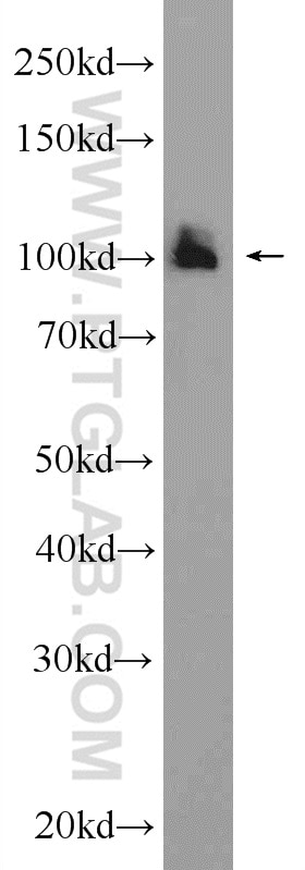 Western Blot (WB) analysis of mouse brain tissue using GRIA4 Polyclonal antibody (23350-1-AP)