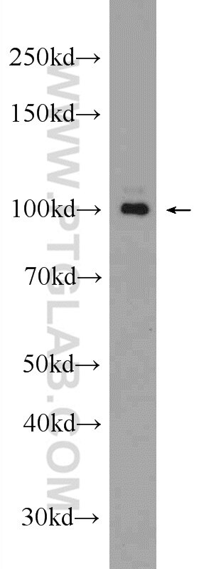 Western Blot (WB) analysis of mouse cerebellum tissue using GRIA4 Polyclonal antibody (23350-1-AP)