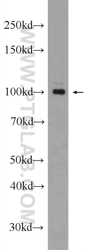 Western Blot (WB) analysis of mouse cerebellum tissue using GRIA4 Polyclonal antibody (23350-1-AP)