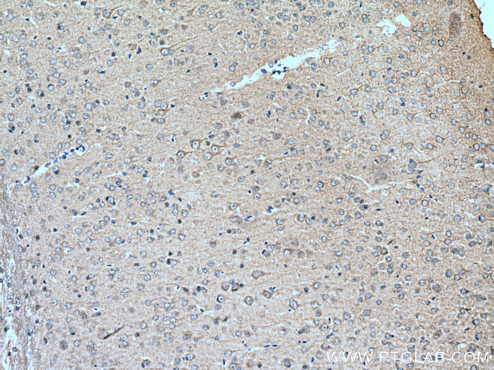 Immunohistochemistry (IHC) staining of mouse brain tissue using GRID1 Polyclonal antibody (13040-1-AP)