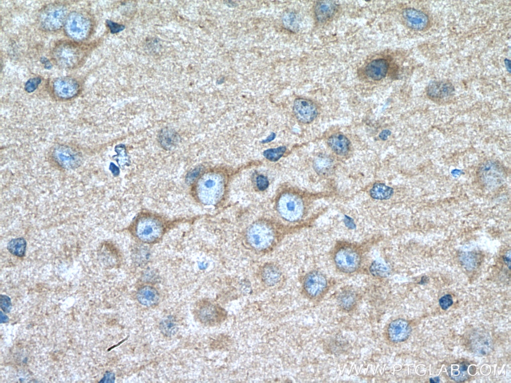IHC staining of mouse brain using 13040-1-AP