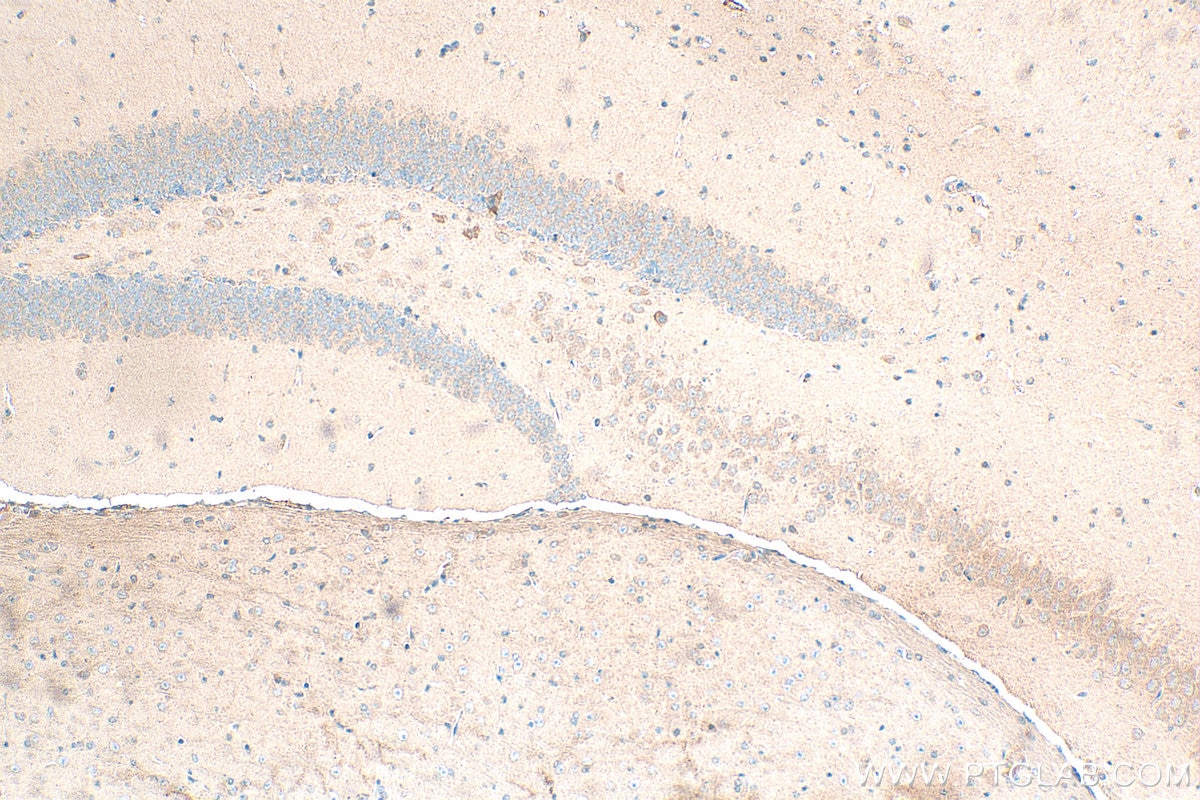 Immunohistochemistry (IHC) staining of mouse brain tissue using GRID1 Polyclonal antibody (13040-1-AP)