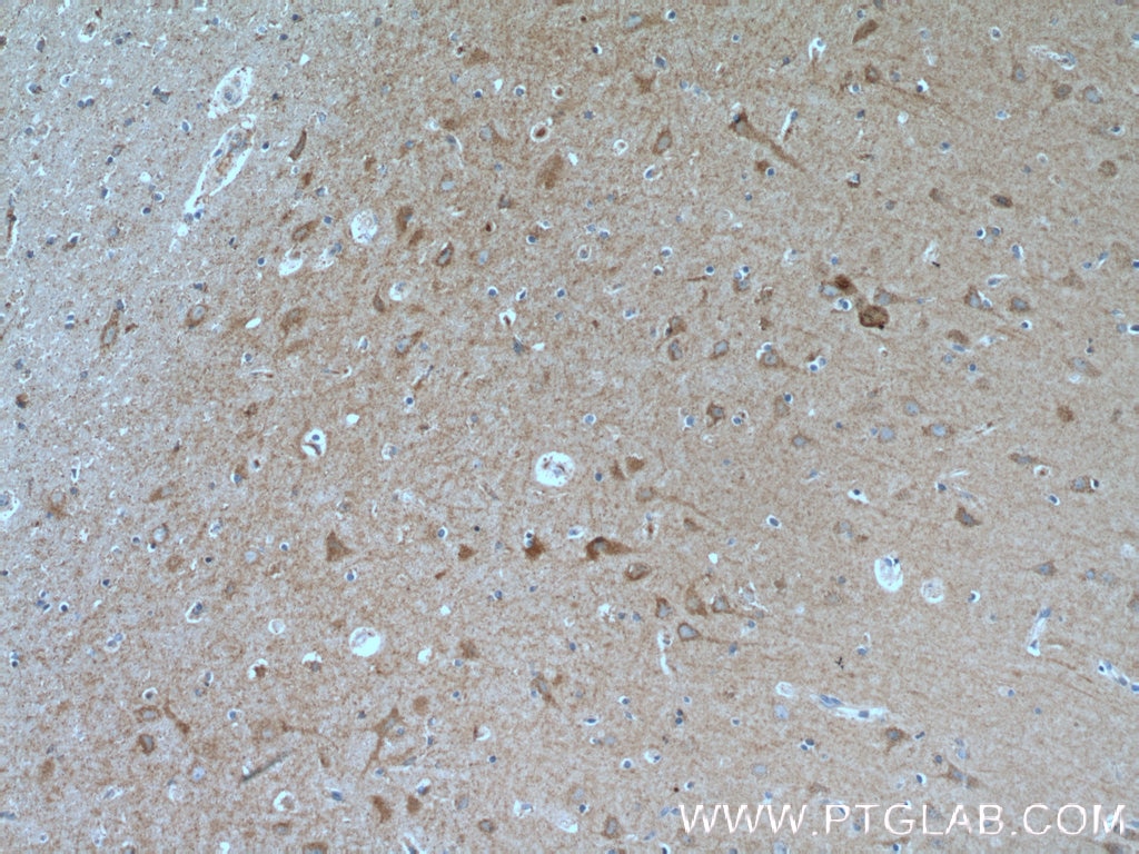 Immunohistochemistry (IHC) staining of human brain tissue using GRID1 Polyclonal antibody (13040-1-AP)