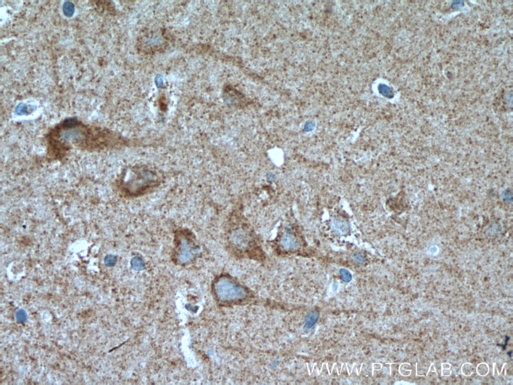 Immunohistochemistry (IHC) staining of human brain tissue using GRID1 Polyclonal antibody (13040-1-AP)