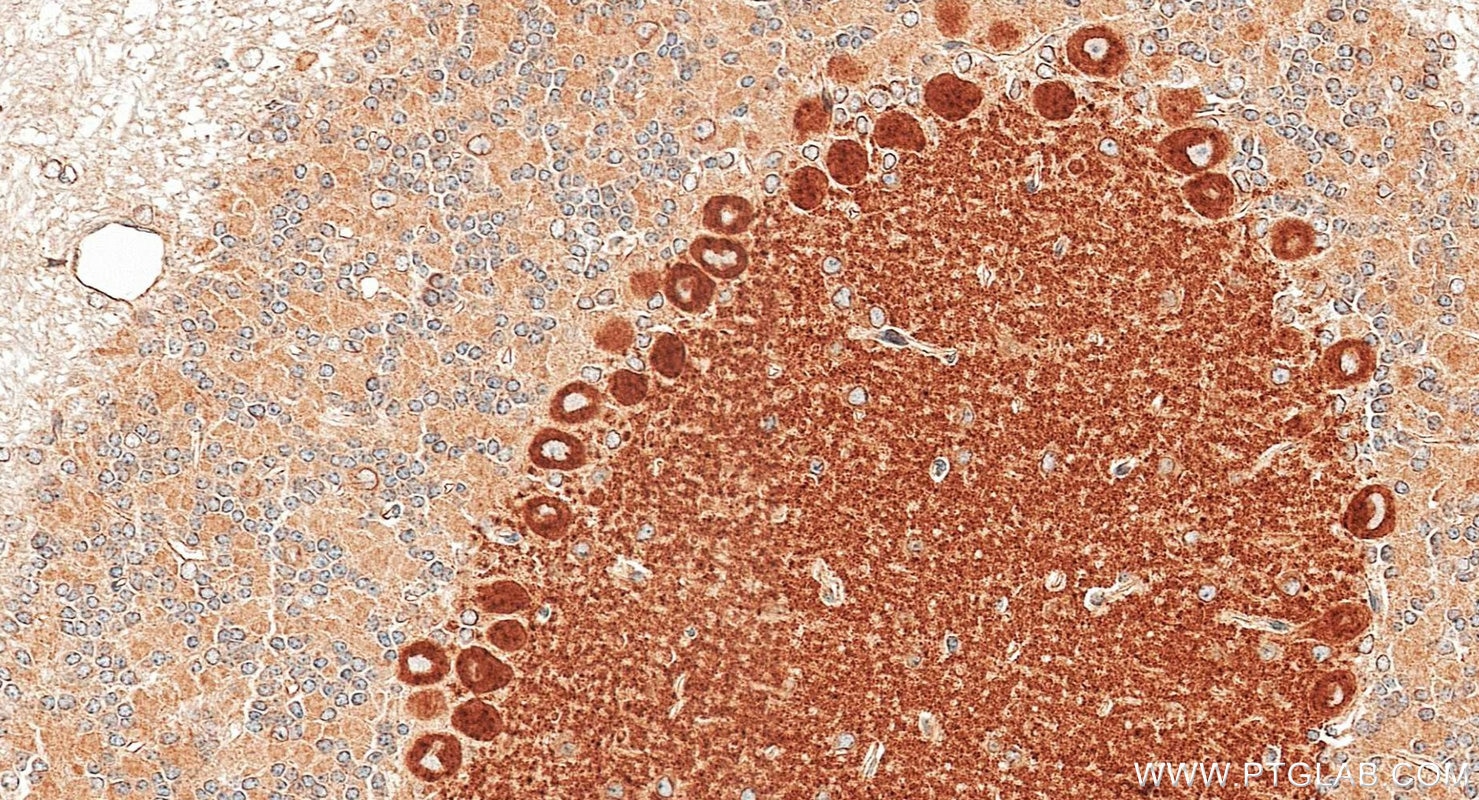IHC staining of mouse cerebellum using 21727-1-AP (same clone as 21727-1-PBS) Immunohistochemistry (IHC) staining of mouse cerebellum tissue using GRID2 Polyclonal antibody (21727-1-AP)