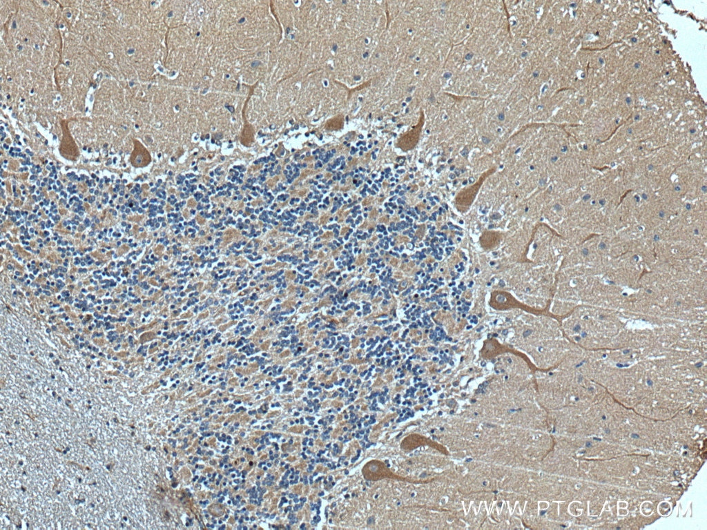 Immunohistochemistry (IHC) staining of human cerebellum tissue using GRIK1 Polyclonal antibody (25779-1-AP)
