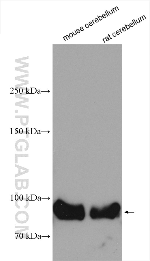 Western Blot (WB) analysis of various lysates using GRIK1 Polyclonal antibody (25779-1-AP)