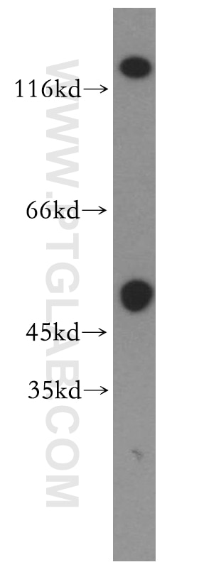 GRIK2 Polyclonal antibody
