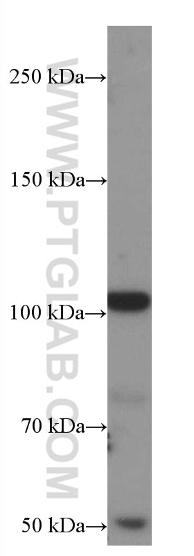 Western Blot (WB) analysis of A431 cells using GRIK2 Monoclonal antibody (66631-2-Ig)