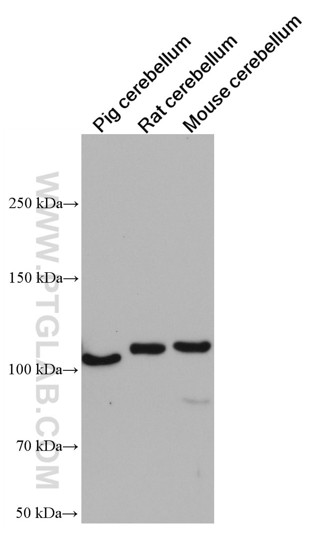 Western Blot (WB) analysis of various lysates using GRIK2 Monoclonal antibody (66631-2-Ig)