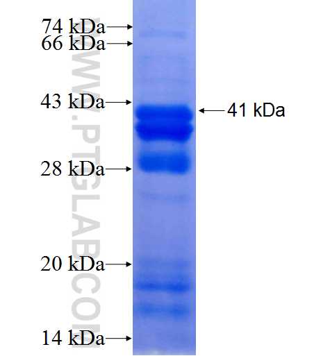 GRIK2 fusion protein Ag25308 SDS-PAGE