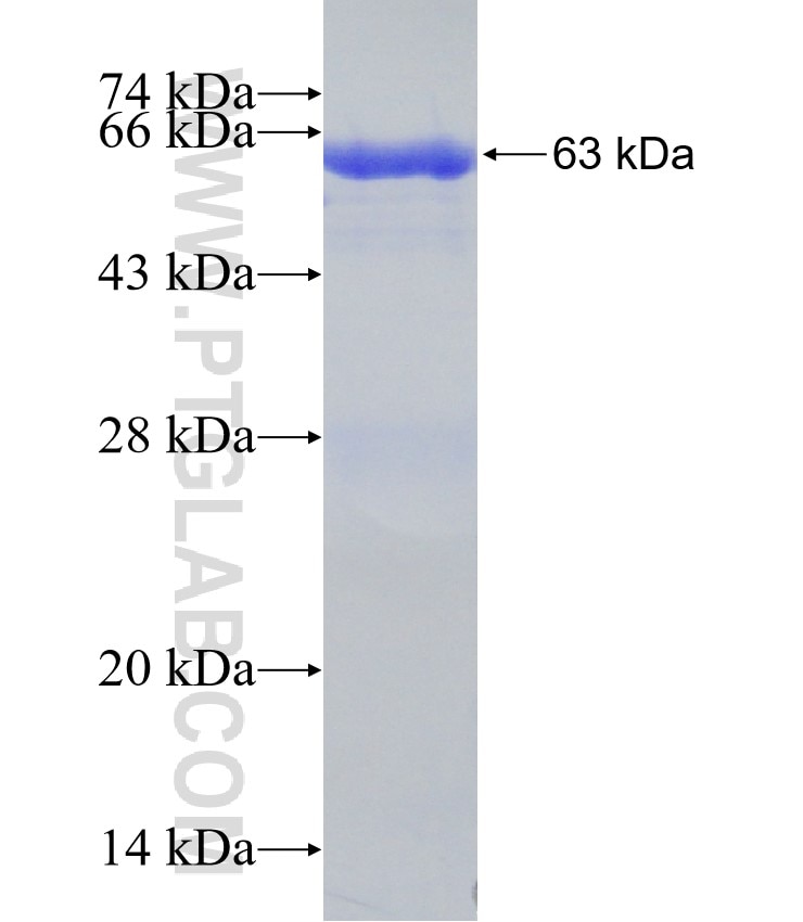 GRIK3 fusion protein Ag31142 SDS-PAGE