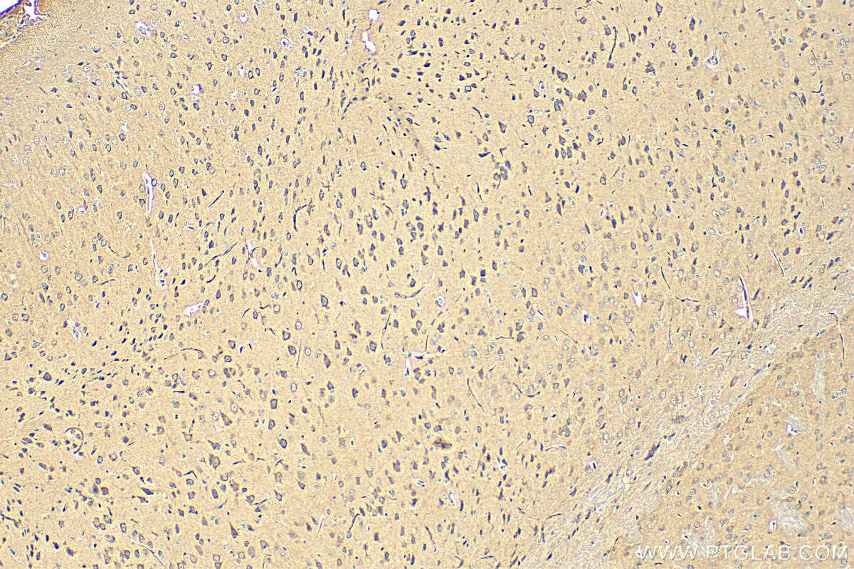 Immunohistochemistry (IHC) staining of mouse brain tissue using GRIK5 Polyclonal antibody (28550-1-AP)