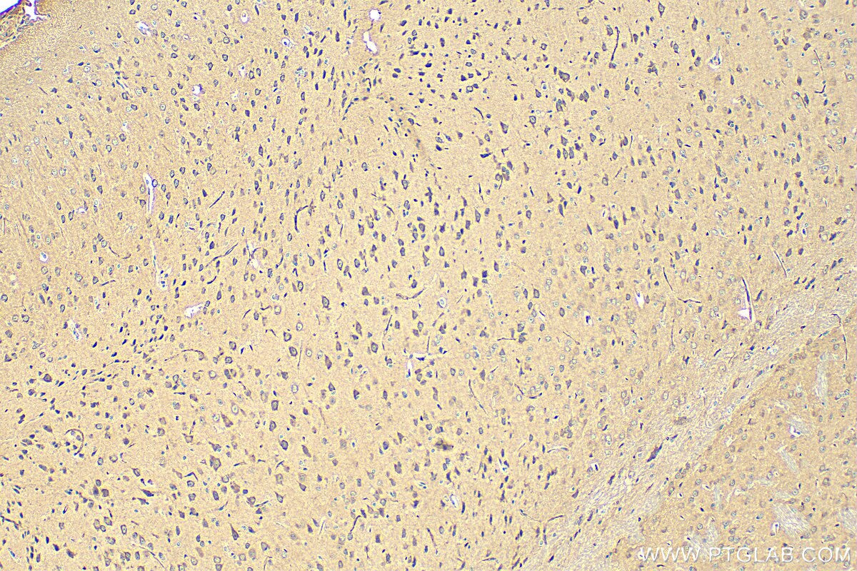 Immunohistochemistry (IHC) staining of mouse brain tissue using GRIK5 Polyclonal antibody (28550-1-AP)