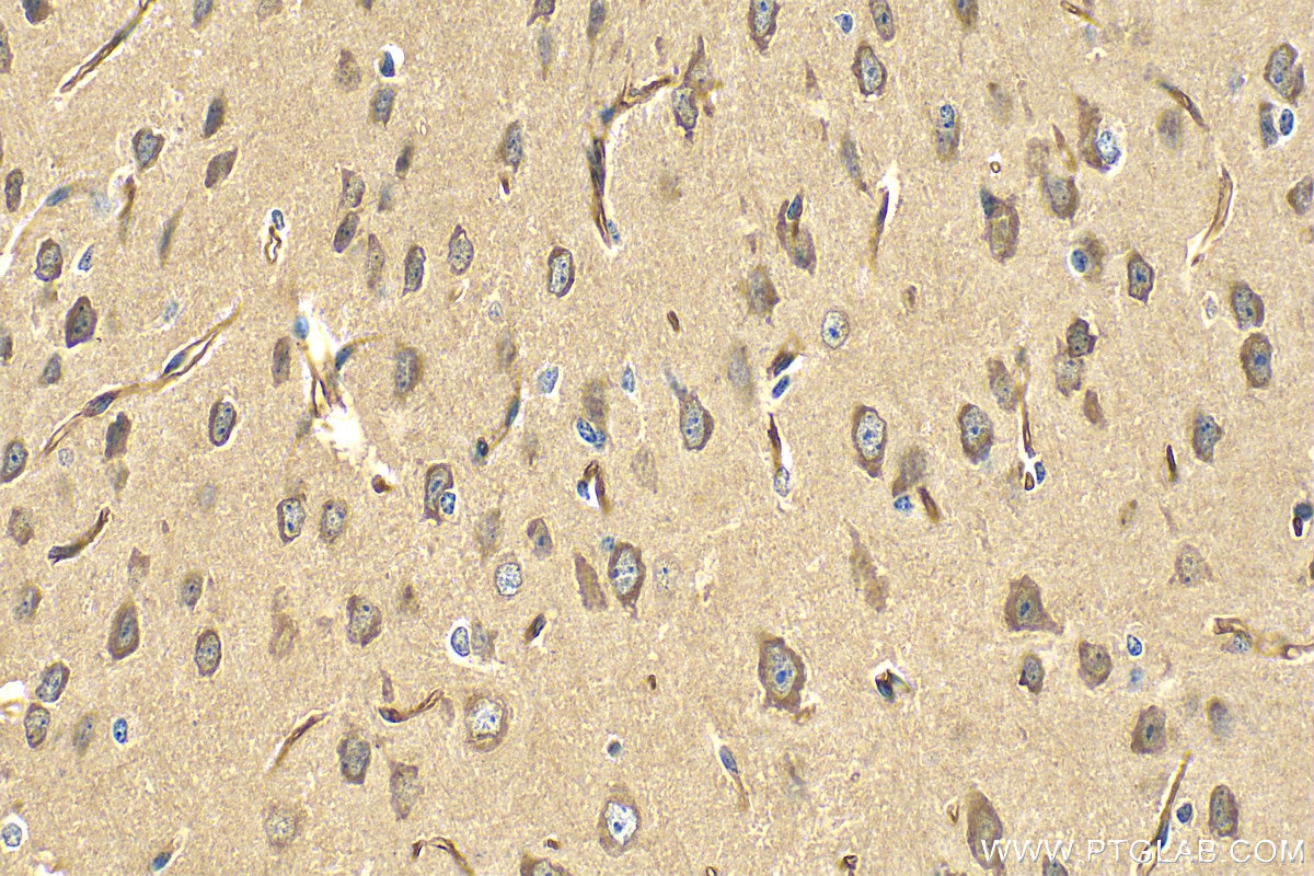 Immunohistochemistry (IHC) staining of mouse brain tissue using GRIK5 Polyclonal antibody (28550-1-AP)