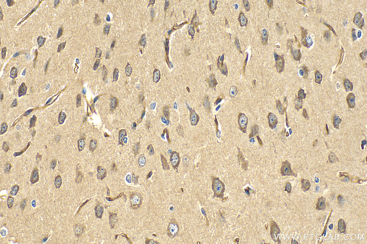 Immunohistochemistry (IHC) staining of mouse brain tissue using GRIK5 Polyclonal antibody (28550-1-AP)