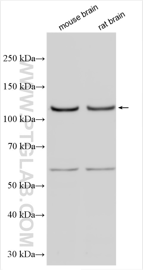 Western Blot (WB) analysis of various lysates using GRIK5 Polyclonal antibody (28550-1-AP)